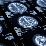 Applying mathematics in the fight against cancer