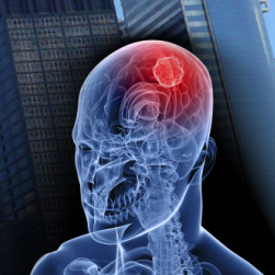 UW Professor Jim Olson's start-up company Blaze Bioscience Raises $8.5M to help surgeons pinpoint cancer with "tumor paint"