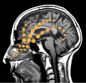 UW Spin-out Impel Neuropharma Named a Top "Innovation in Medical Devices" by Seattle Business Magazine